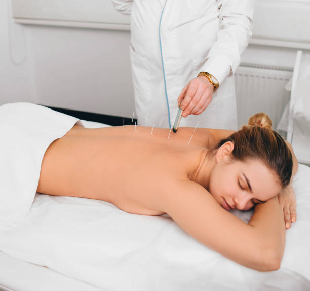 Acupuntura terapéutica: agujas finas en puntos meridianos para hernia discal y dolor lumbar crónico
