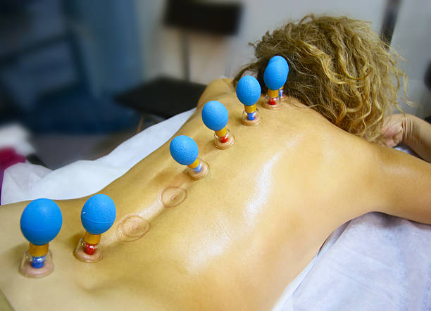 Terapia con ventosas en región lumbar: liberación de tensión miofascial para hernia discal