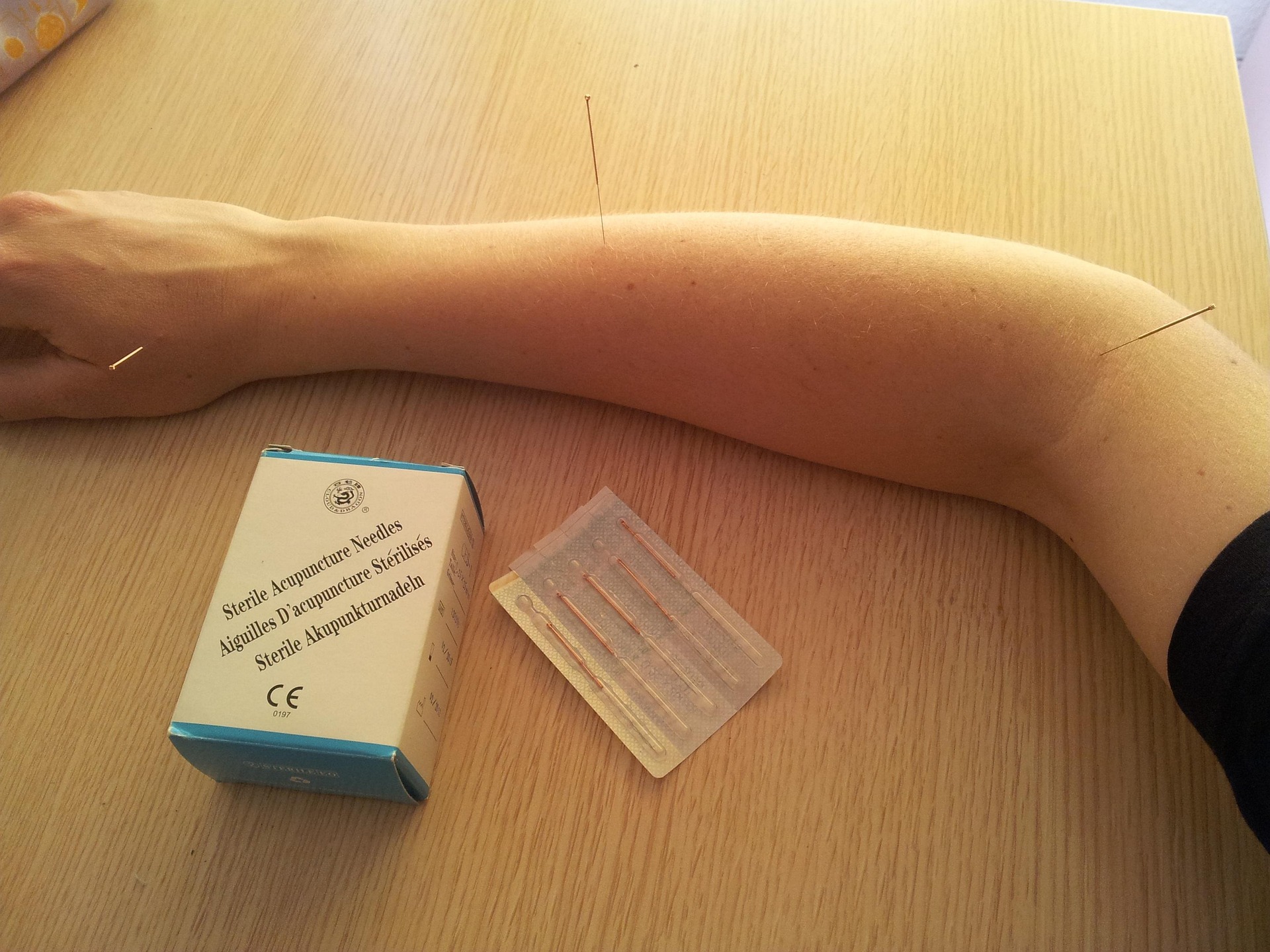 Acupuntura para el dolor crónico – Consultorio Alíviate, Dr. Pedro Estrada, Medellín Acupuntura para el dolor crónico y estancamiento de Qi y Sangre según la Medicina Tradicional China en Medellín