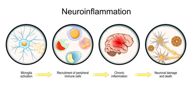 Biomarcadores de inflamación en estrés crónico: PCR ultrasensible, IL-6 y cortisol salival