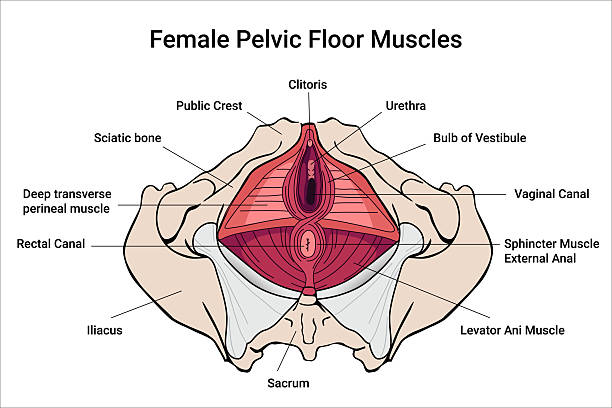 Diagrama anatómico del suelo pélvico femenino mostrando puntos de tensión muscular relacionados con cistitis intersticial